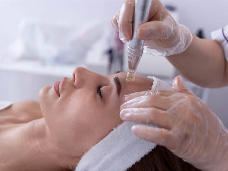 Microneedling | Helsinki, Espoo, Kauniainen