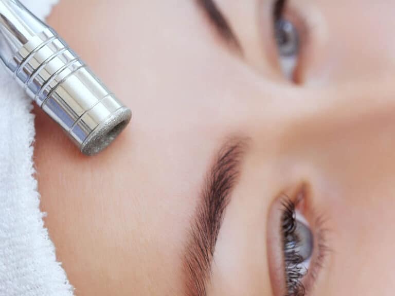 Diamond microdermabrasion | Helsinki, Espoo, Kauniainen