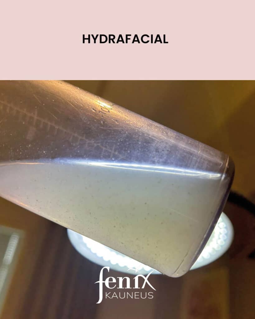 HydraFacial-sailion sisaltoa lahikuvassa, sailion sivulta pain kuvattuna. Ihosta imetyt epapuhtaudet lilluvat sailiossa olevan hoitonesteen seassa.