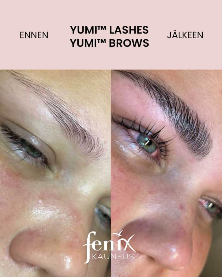 Pitkat ripset ja tuuheat kulmakarvat ennen ja jalkeen YumiLashes -ripsien kestotaivutuksen ja YumiBrows -kulmakarvojen laminointihoidon.