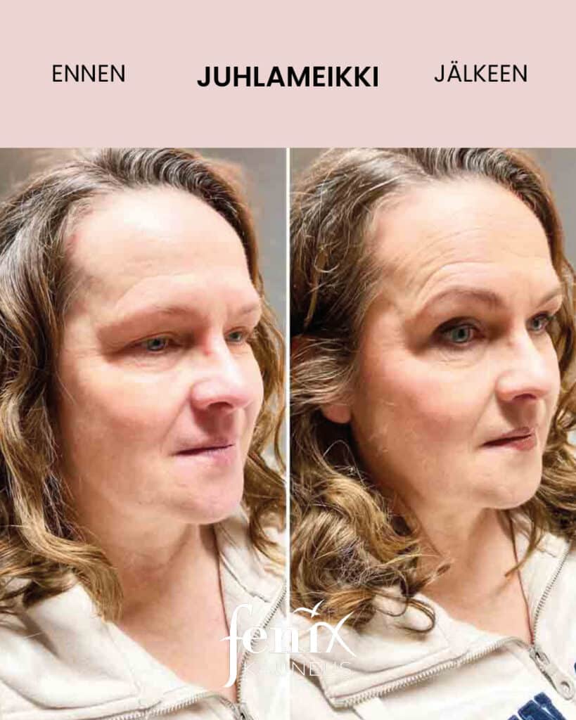 Aikuisen naisen meikki ennen ja jalkeen meikkauksen.