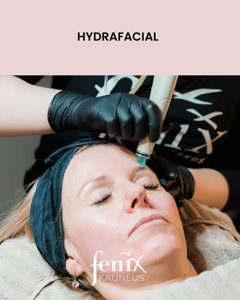 HydraFacial -hoitopaa on asiakkaan otsalla, kun asiakkaalle tehdaan HydraFacial-hoitoa.