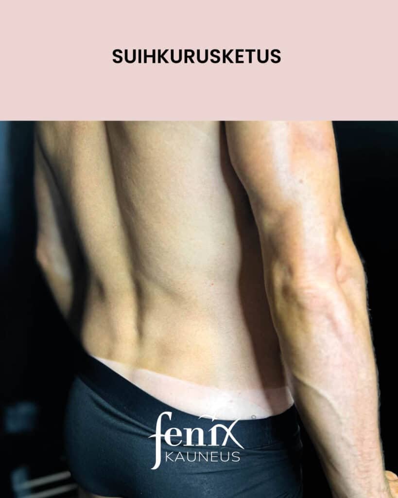 Nordic Tan -rusketusrajat miehella suihkurusketuksen jalkeen.