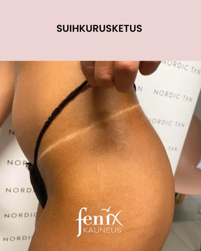 Nordic Tan -rusketusrajat suihkurusketuksen jalkeen.