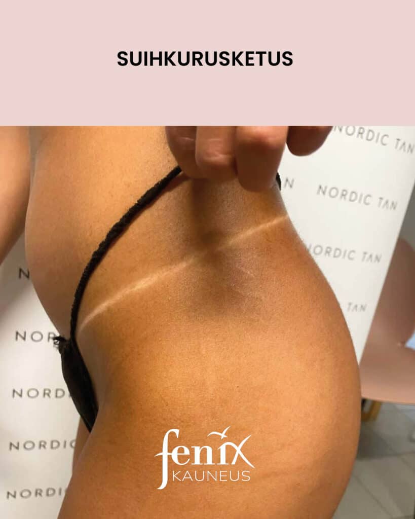 Nordic Tan -rusketusrajat suihkurusketuksen jalkeen.