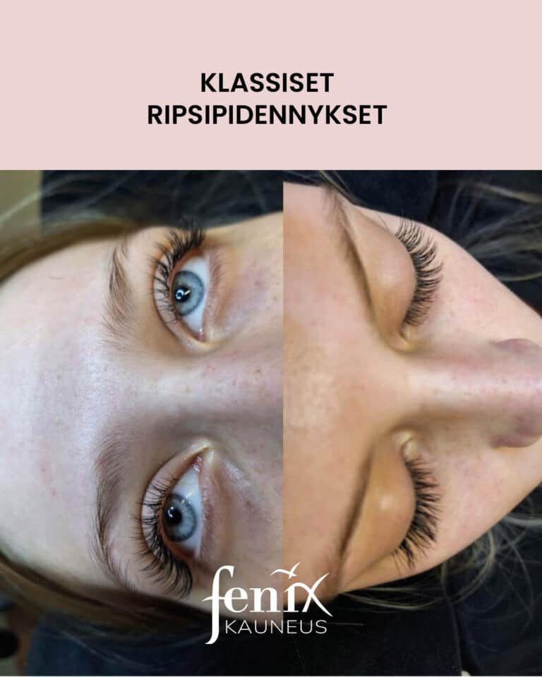 Klassinen ripsienpidennys kuvattuna seka edesta silmat auki etta ylaviistosta silmat kiinni.