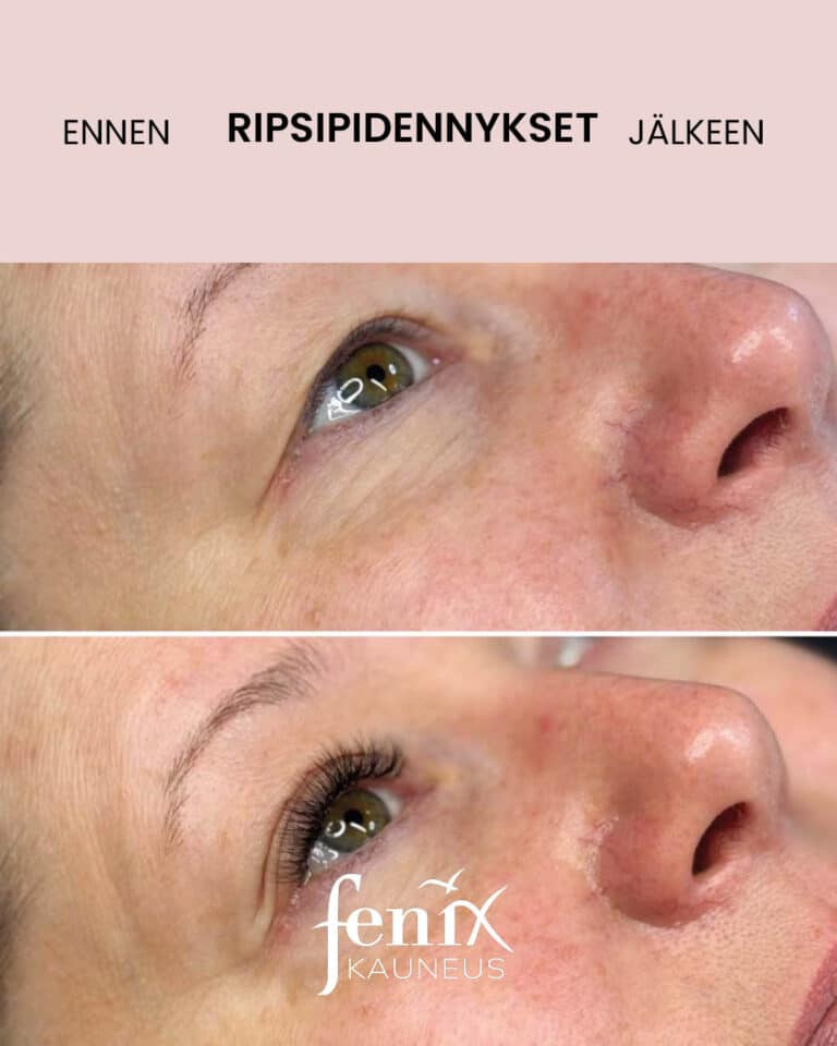 Ripset ennen ja jalkeen ripsienpidennyksen.