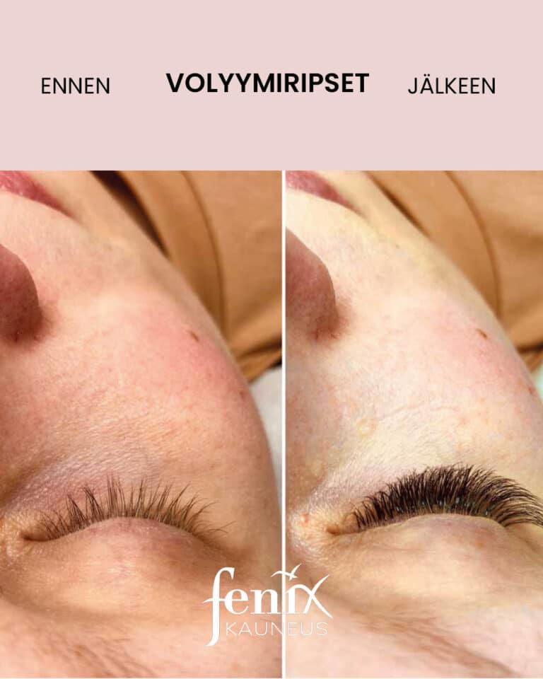 Ripset kuvattuna ylaviistosta ennen ja jalkeen volyymiripsipidennyksen.