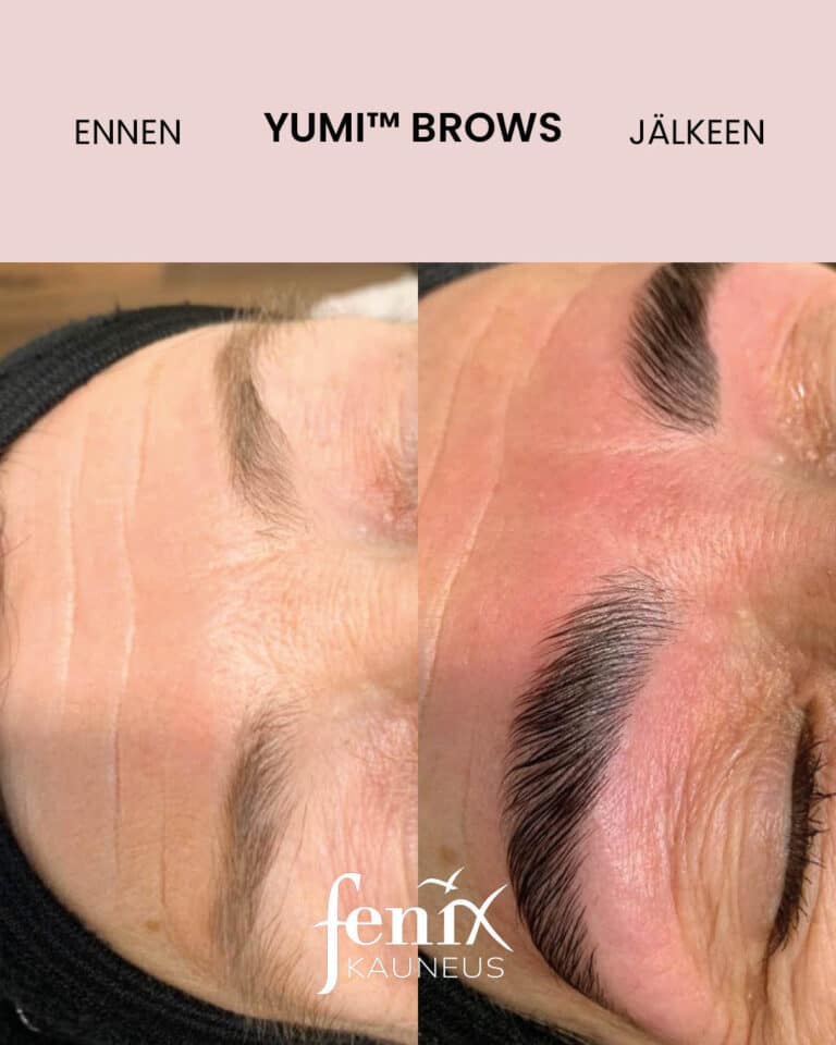 Aikuisen naisen tuuheat kulmakarvat ennen ja jalkeen YumiBrows kulmakarvojen laminoitihoidon.