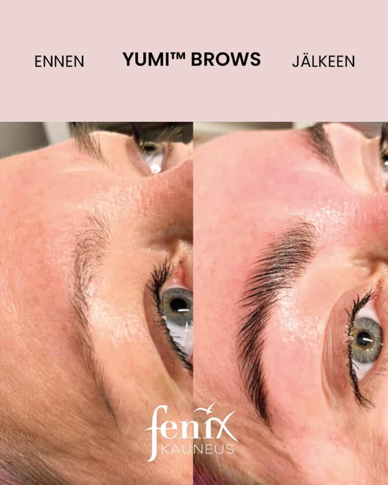 Enne ja jalkeen YumiBrows kulmakarvojen laminointihoidon.