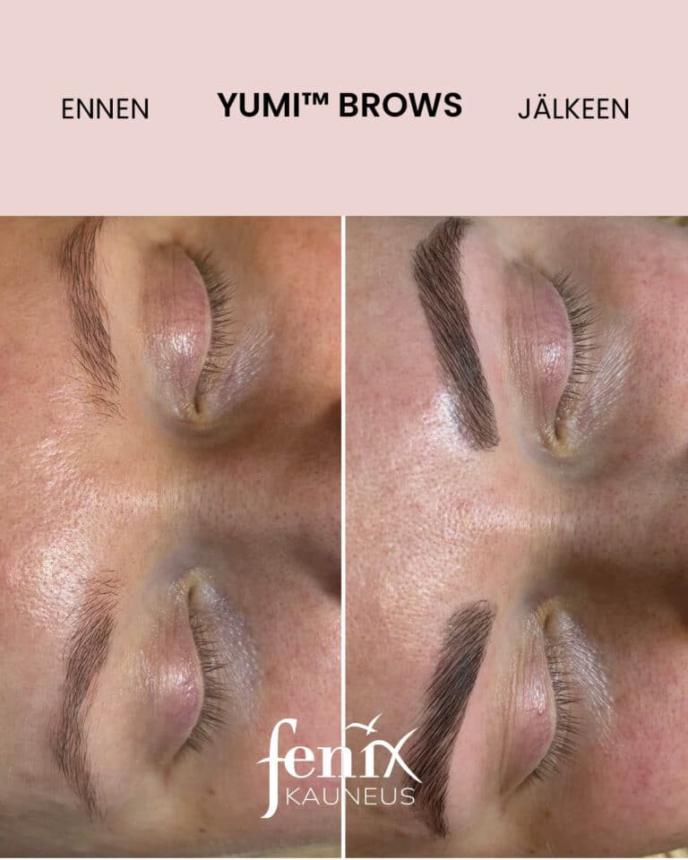 Yumi Brows -kulmakarvojen laminointi ennen hoitoa ja hoidon jalkeen.