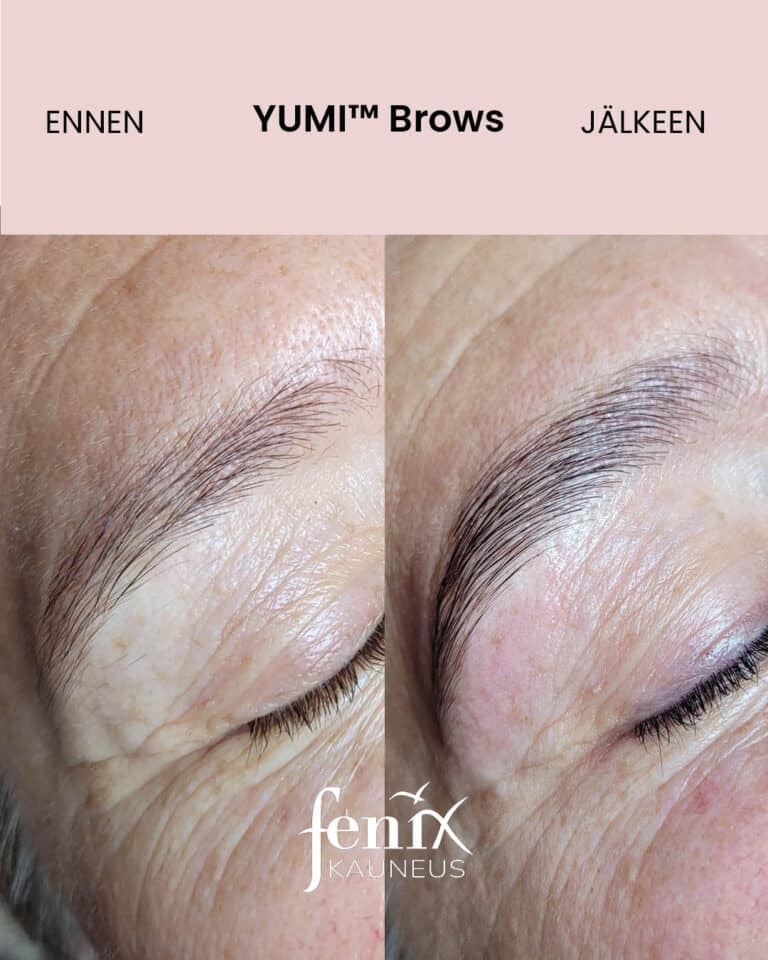Ennen ja jalkeen YumiBrows kulmakarvojen laminointihoidon.