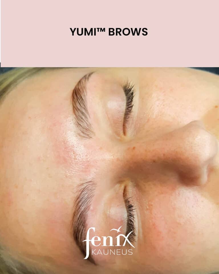 Nuoren naisen kulmakarvat YumiBrows kulmakarvojen laminoinnin jalkeen.