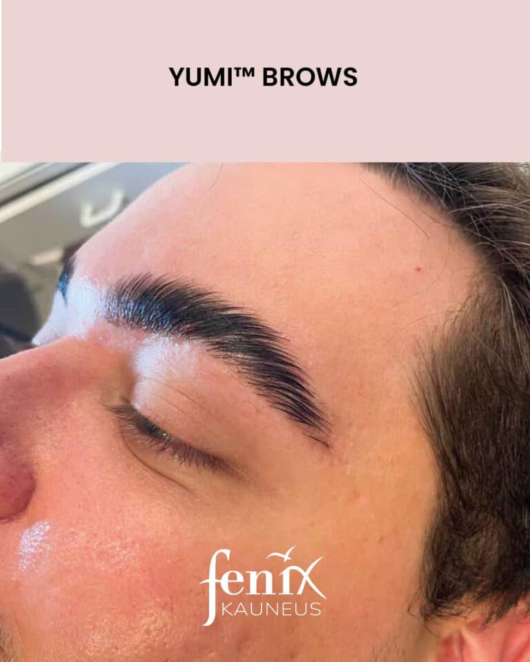 Nuoren miehen tuuheat kulmakarvat jalkeen YumiBrows kulmakarvojen laminointihoidon.