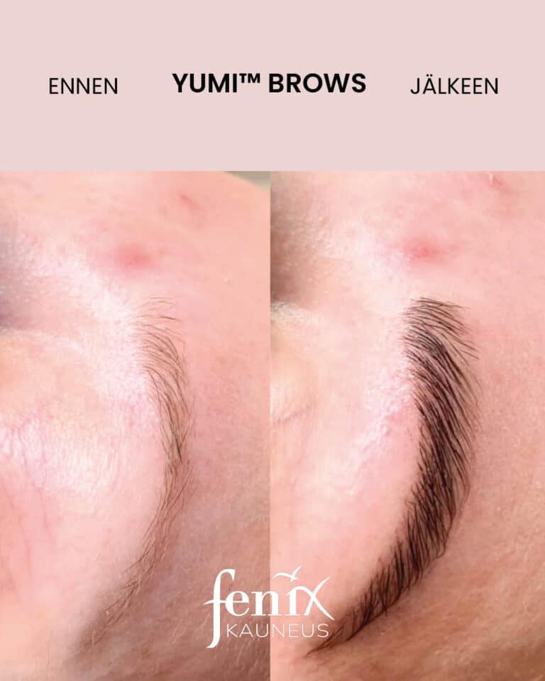 Ohuiden kulmakarvojen muodonmuutos YumiBrows kulmakarvojen laminoinnin jalkeen.