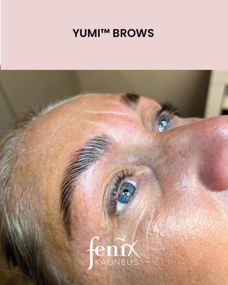 YumiBrows brow liftin jalkeen.