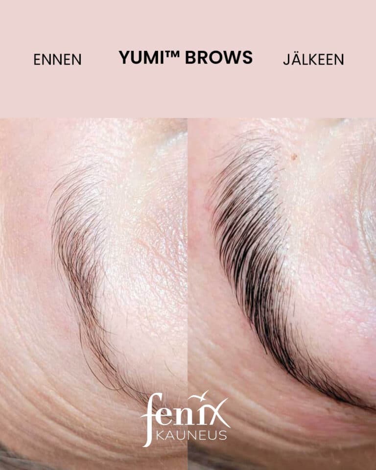 Ennen ja jalkeen YumiBrows kulmakarvojen laminointihoidon.
