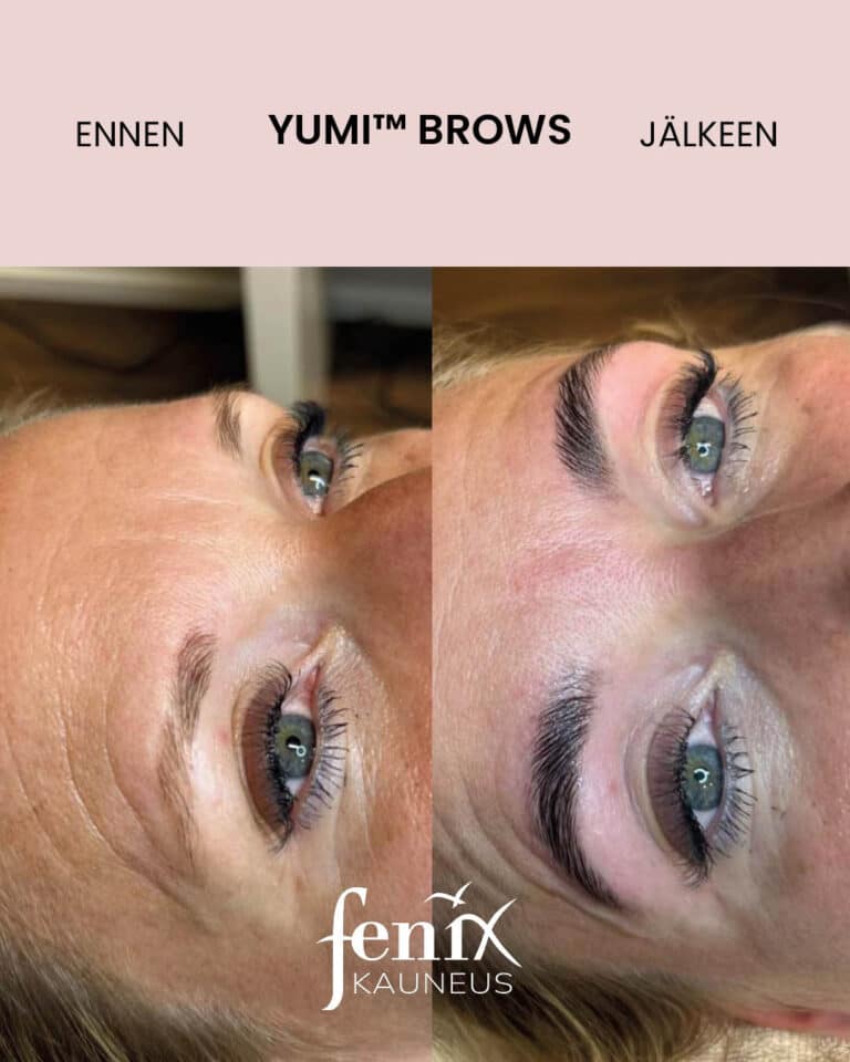 Kulmakarvat ennen ja jalkeen YumiBrows kulmakarvojen laminointihoidon.