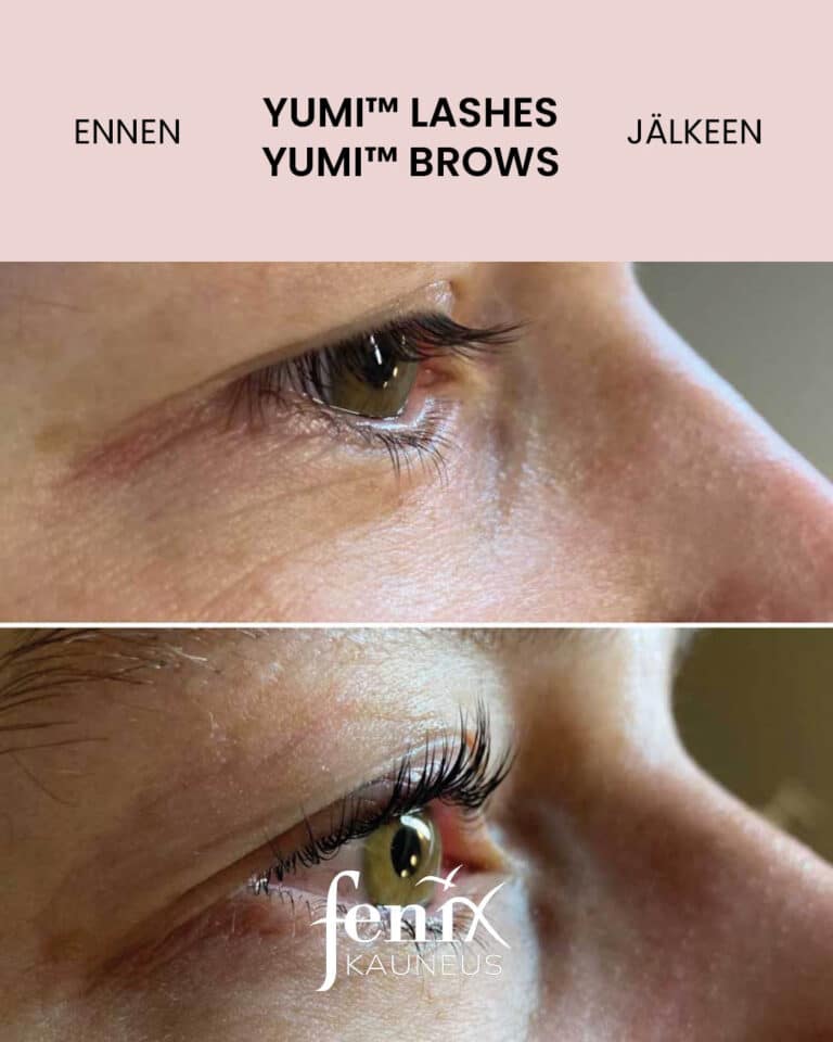 Yumikombo sivusta pain otettu kuva ennen ja jalkeen.