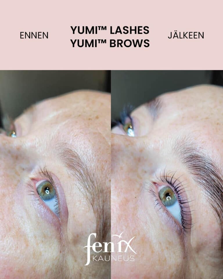Ennen ja jalkeen YumiLashes ja YumiBrows hoidon.