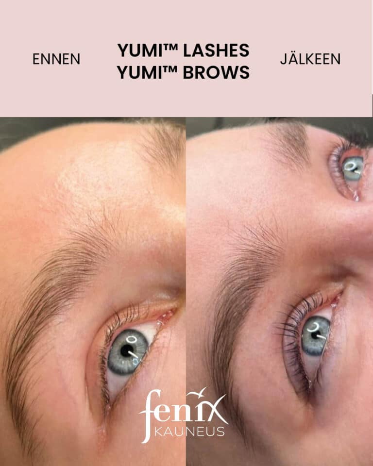Nuoren naisen ripset ja kulmat YumiLashes -ripsien kestotaivutuksen ja YumiBrows -kulmien laminoinnin jalkeen.