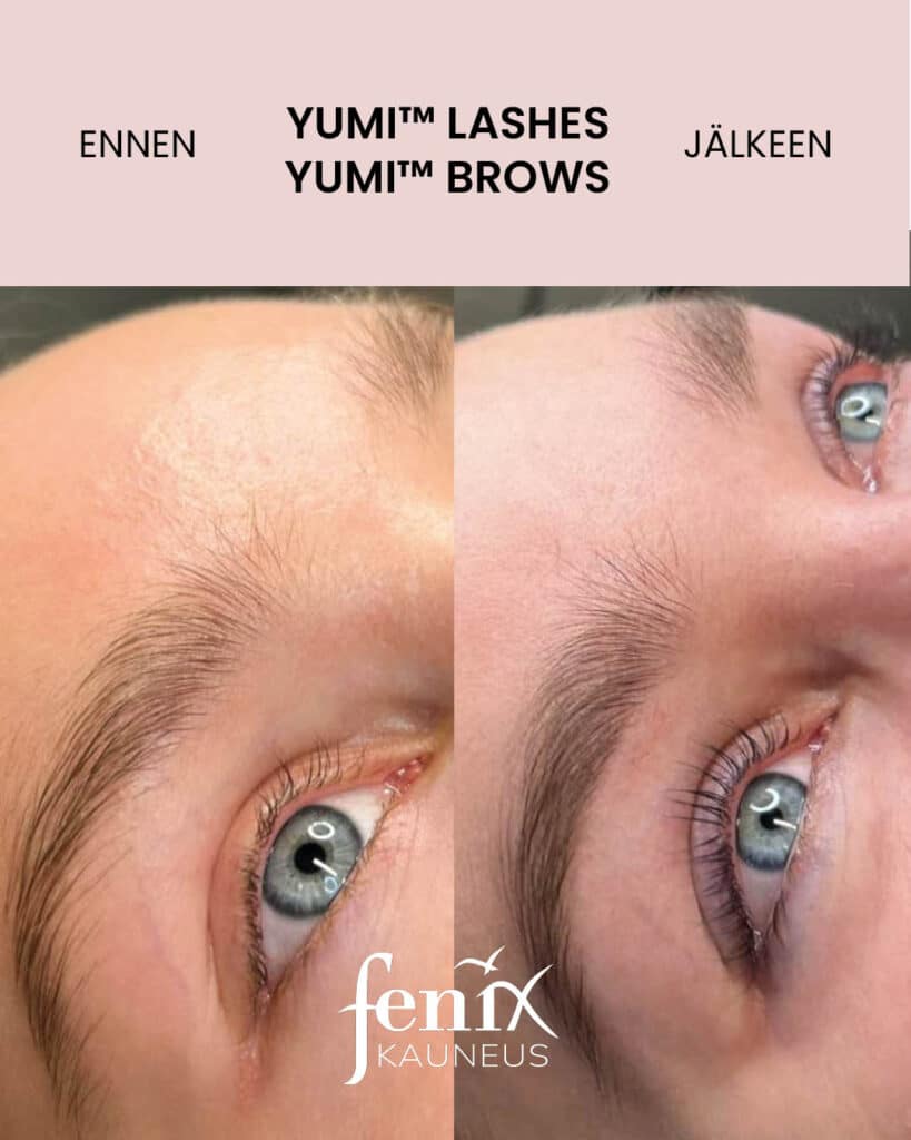 Nuoren naisen ripset ja kulmat YumiLashes -ripsien kestotaivutuksen ja YumiBrows -kulmien laminoinnin jalkeen.