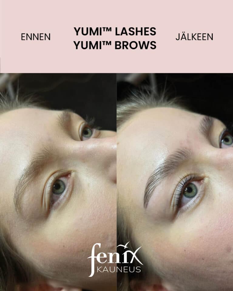 Nuoren henkilon ripset ja kulmakarvat YumiLashes- lashliftin ja YumiBrows- browliftin jälkeen.