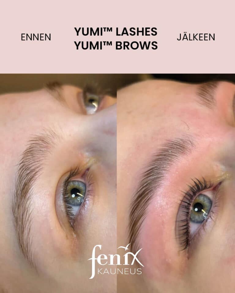 Nuoren naisen ripset ja kulmat YumiLashes -ripsien kestotaivutuksen ja YumiBrows -kulmien laminoinnin jalkeen.