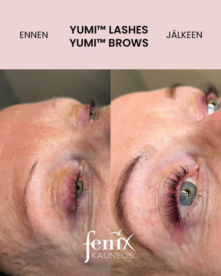 Vanhemman naisen ripset ja kulmat ennen ja jalkeen YumiLashes -ripsienkestotaivutuksen ja YumiBrows -kulmien laminointihoidon.