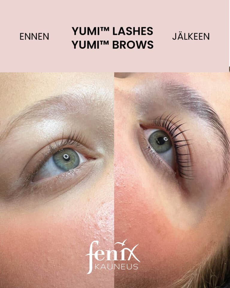 Upea muodonmuutos ripsissa ja kulmissa YumiLahes- ripsien kestotaivutuksen ja YumiBrows -kulmien laminoinnin jalkeen.