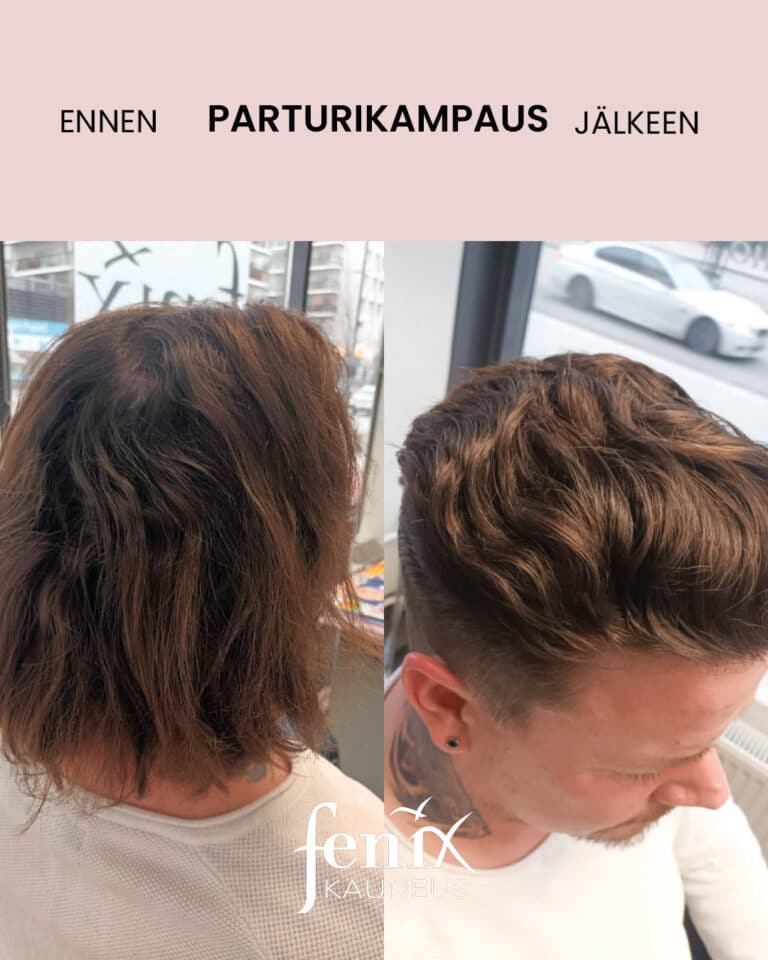 Pitkan tumman tukan muodonmuutos miehella.