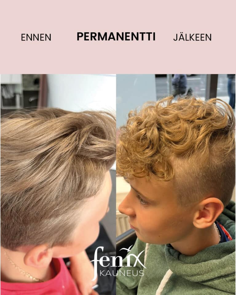 Nuoren miehen permanentti muodonmuutos.