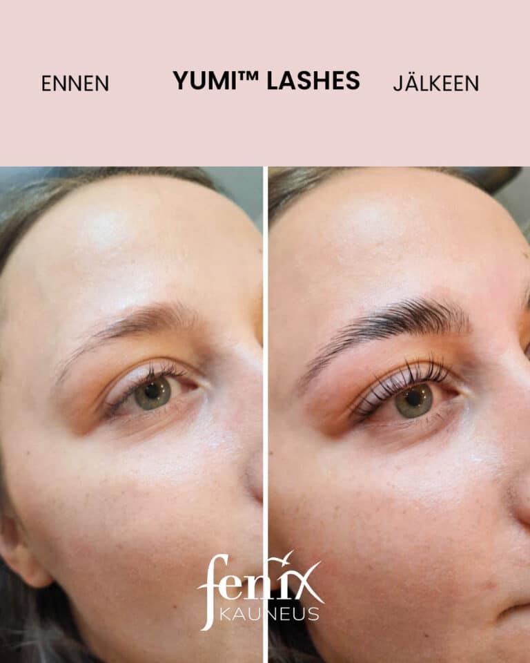 Yumilashes ennen ja jalkeen.