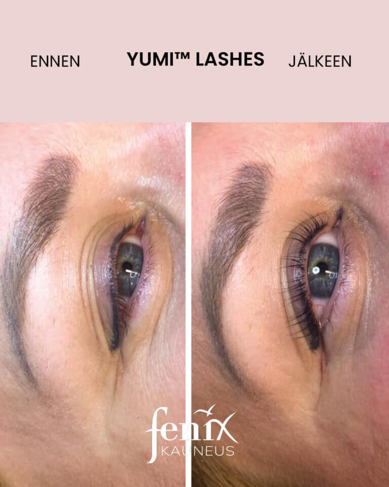 Yumilashes ennui ja jalkeen upeat.