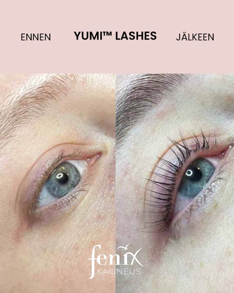 YumiLashes -kestotaivutetut ripset sinisissa silmissa ennen ja jalkeen hoidon.
