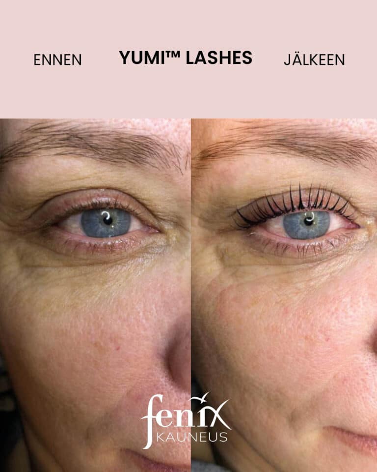 Näyttävät ripset YumiLashes ripsien kestotaivutushoidon jalkeen.