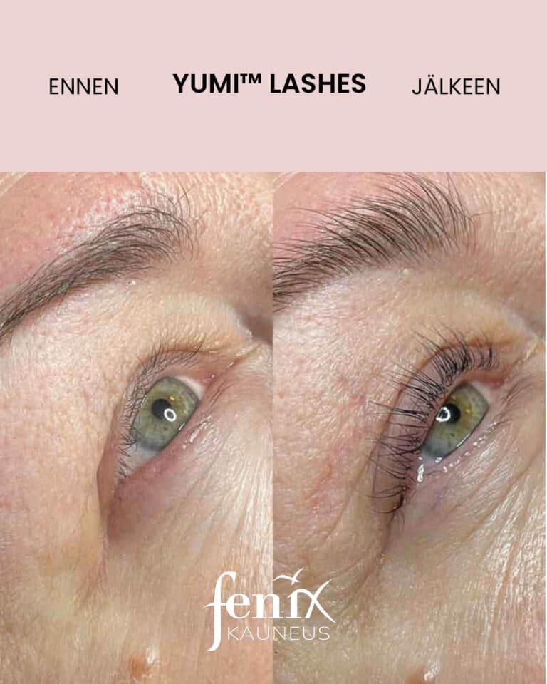 Aikuisen henkilön ripset YumiLashes ripsien kestotaivutuksen jalkeen.