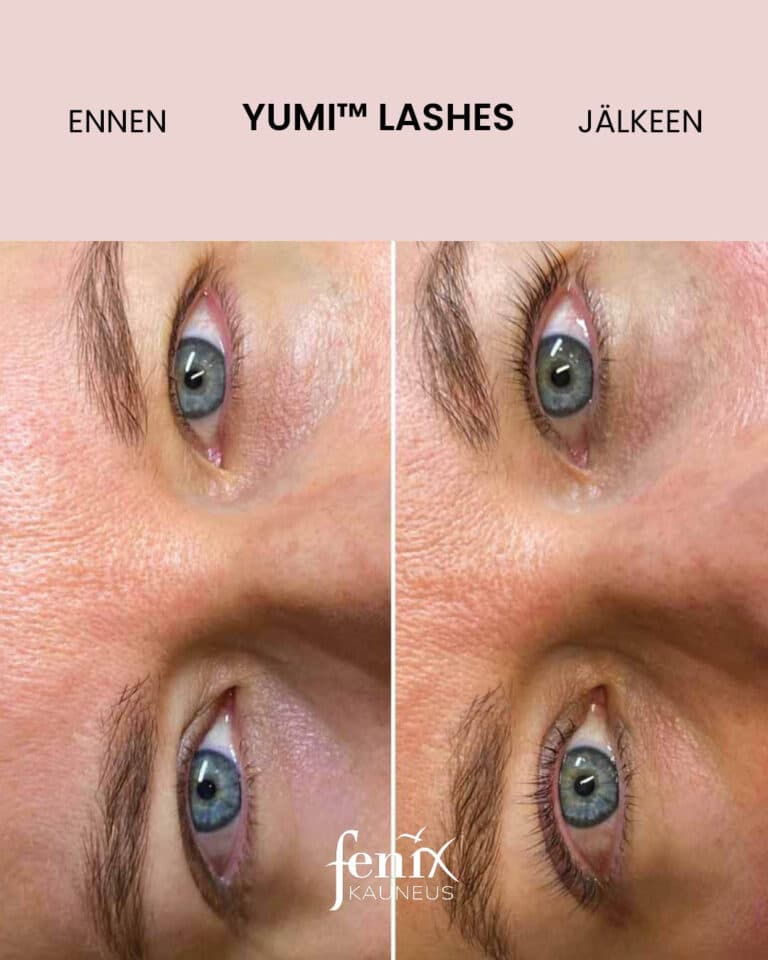 Ripset sinisilla silmilla ennen ja jalkeen YumiLashes ripsien kestotaivutuksen.