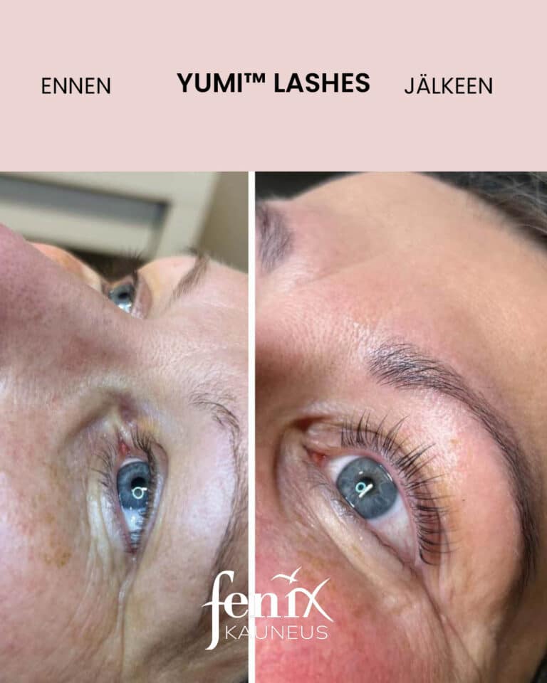Aikuisen naisen ripset ennen ja jalkeen YumiLashes ripsien kestotaivutushoidon.