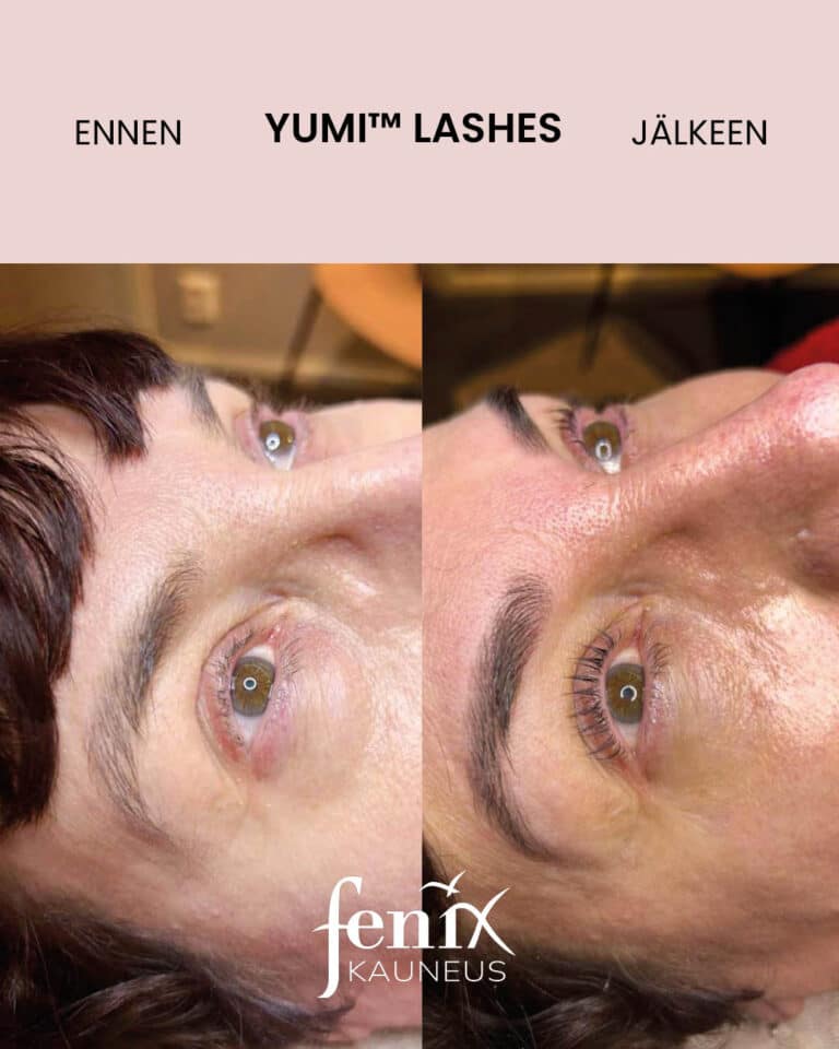 Aikuisen naisen ripset ennen ja jalkeen YumiLashes ripsien kestotaivutushoidon.
