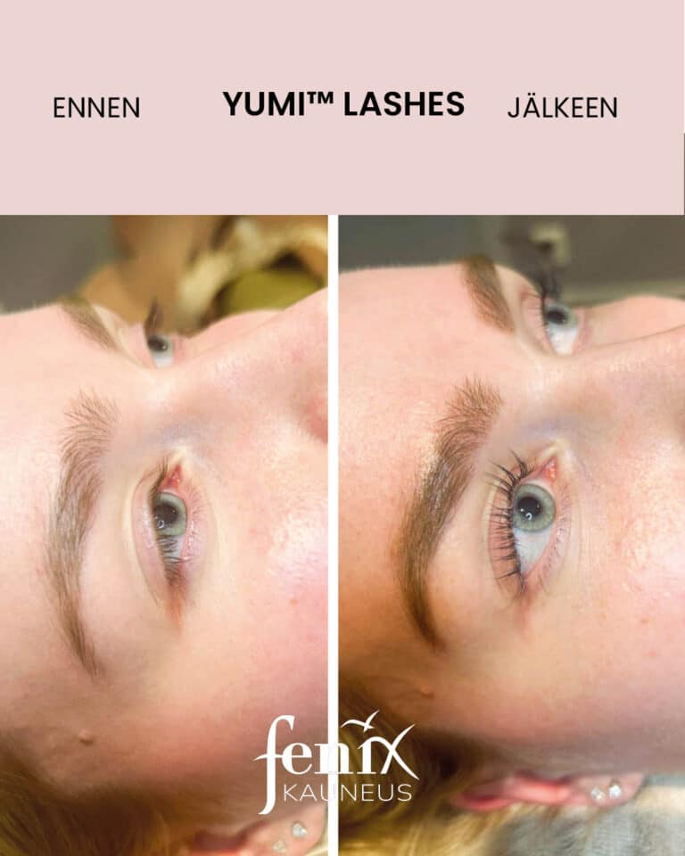 Pitkat ripset ennen ja jalkeen YumiLashes lashlifthoidon.