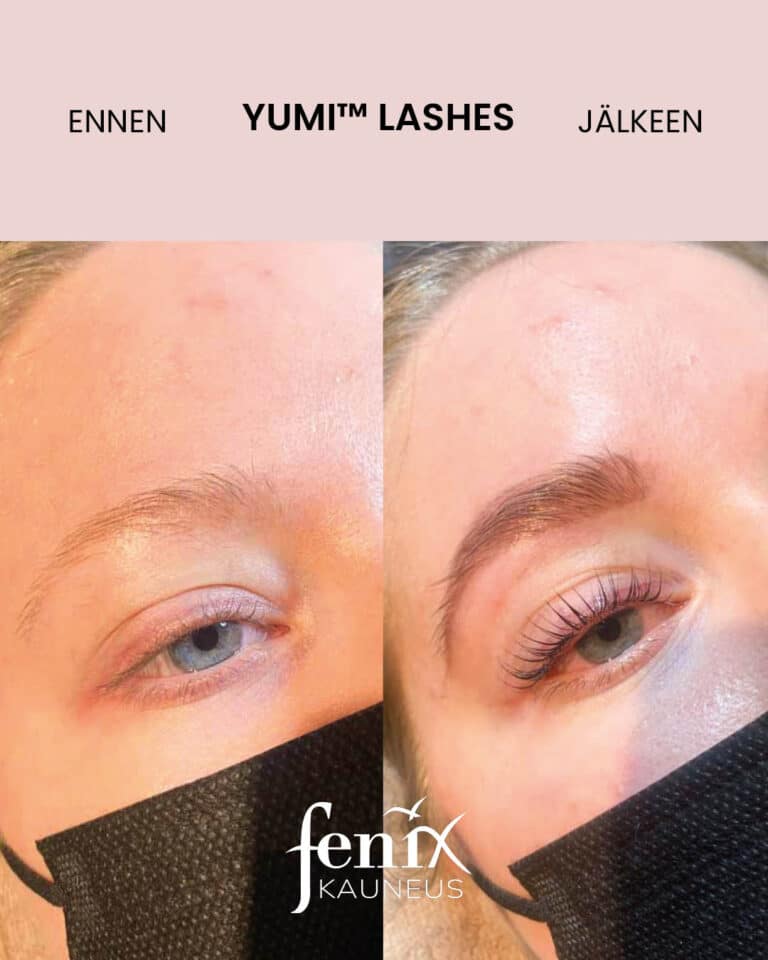 Pitkat ripset ennen ja jalkeen YumiLashes ripsien kestotaivutushoidon.