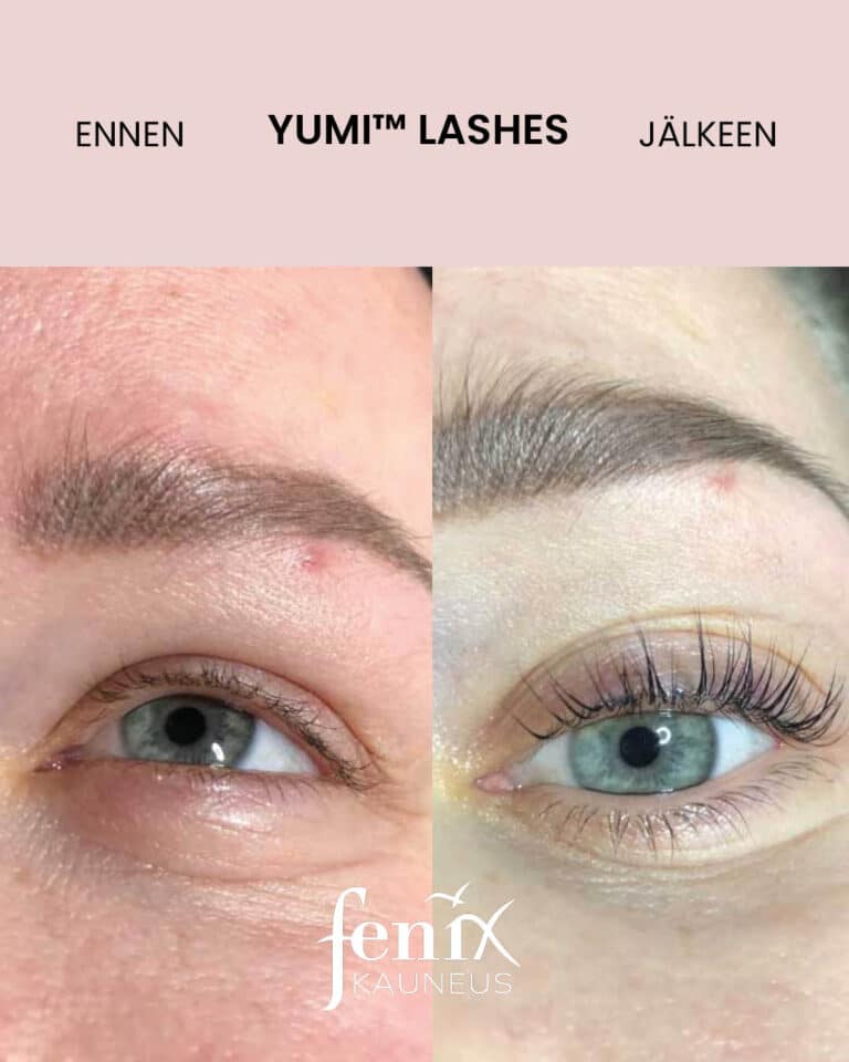 Pitkat ripset ennen ja jalkeen YumiLashes lashlifthoidon.