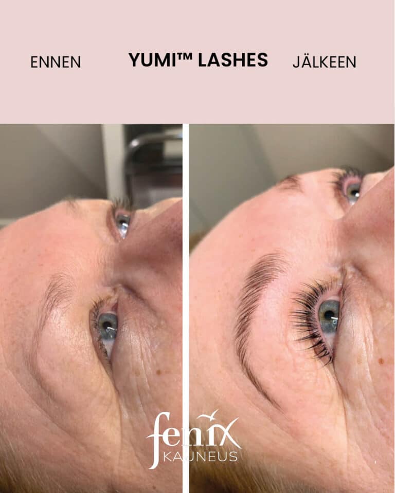 Ennen ja jälkeen ripset YumiLashes lashlifhoidon.