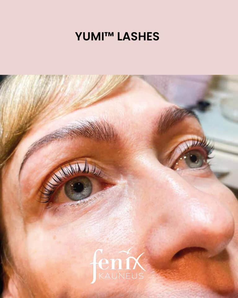 Ripset jalkeen YumiLashes lashlifthoidon.