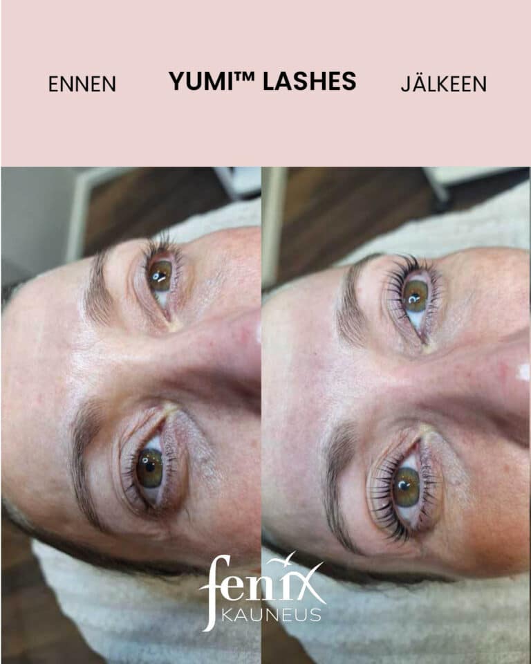 Aikuisen naisen ripset ennen ja jalkeen YumiLashes ripsien kestotaivutushoidon.