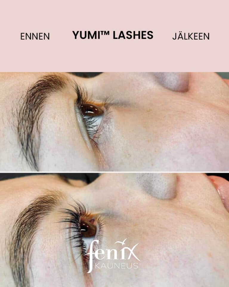 Pitkien ripsien ennen ja jalkeen kuvat sivusuunnasta YumiLashes ripsien kestotaivutushoidosta.