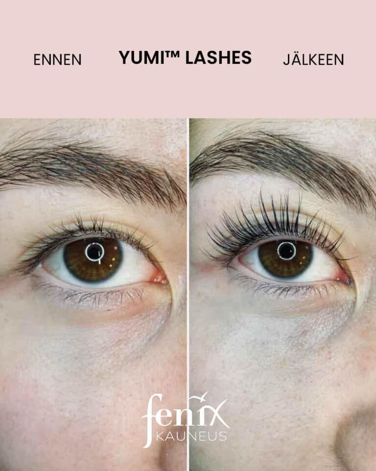 Todella pitkien ripsien ennen ja jalkeen YumiLashes ripsien kestotaivutushoidon.