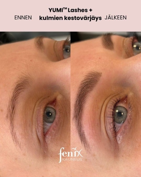 Yumi ripsien kestotaivtus jalkeen kulmien kestovarjays
