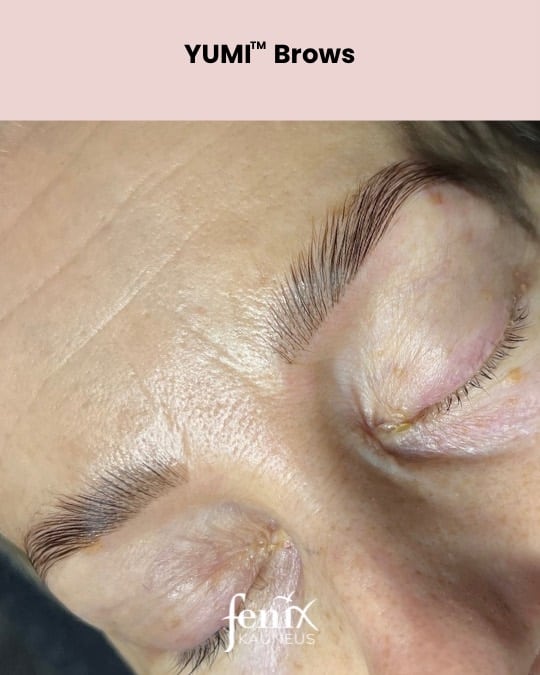 Yumi brows kulmien laminointi jalkeen hoidon aikuiselle naiselle